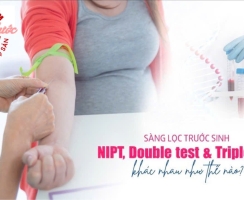 SO SÁNH GIỮA CÁC PHƯƠNG PHÁP XÉT NGHIỆM SÀNG LỌC TRƯỚC SINH (DOUBLE TEST-TRIPLE TEST-NIPT)